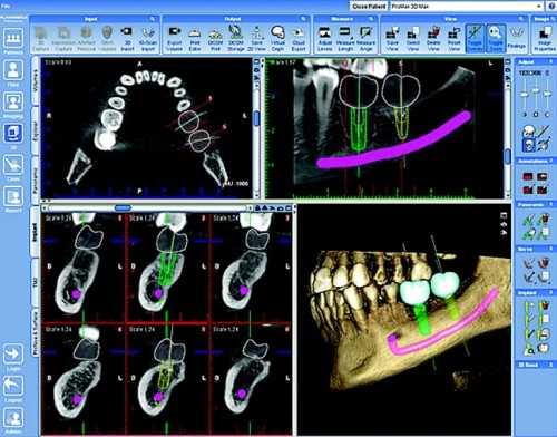 3D stomatoloģiskais panorāmas rentgens