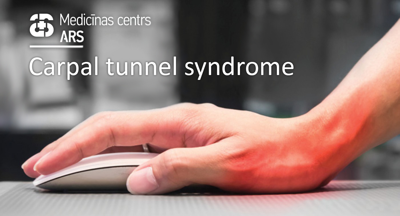 Numb and painful hands – carpal tunnel syndrome - Medicīnas centrs ARS